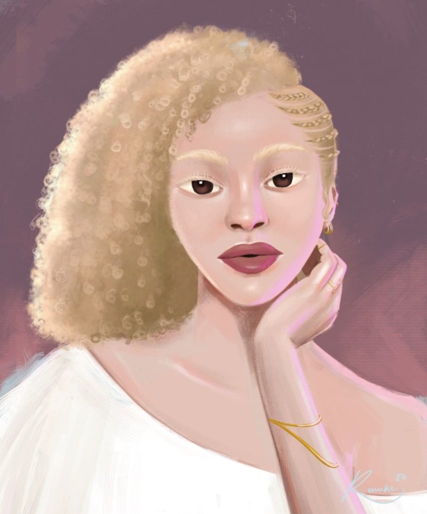 Albino Woman, 2020 by Renike Olusanya
